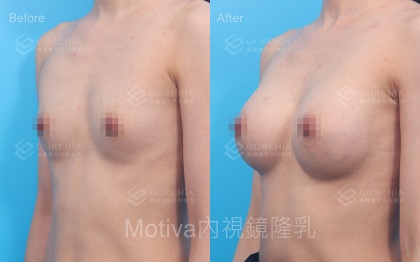 MOTIVA魔滴-8
