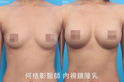 MOTIVA魔滴-44