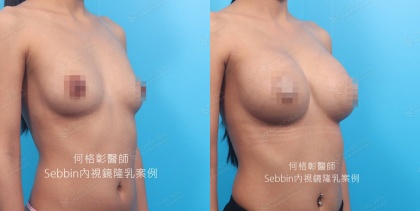 SEBBIN柔滴-7